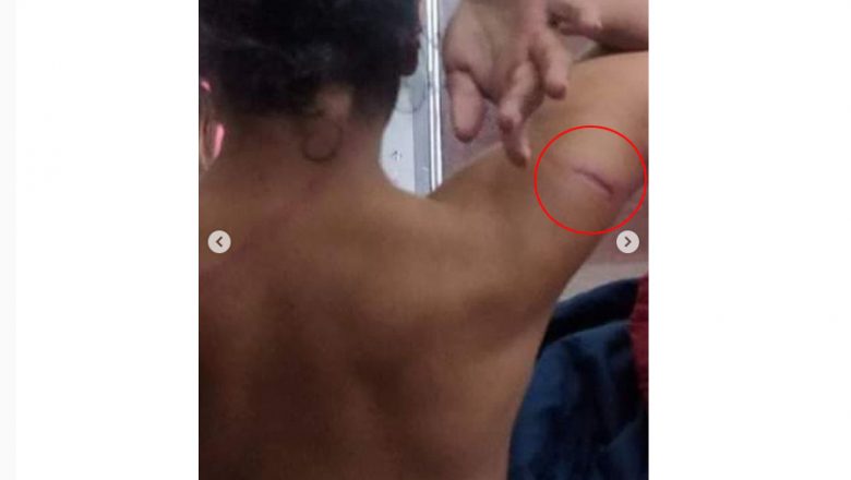 पारलैङ्गिक समूहमाथि प्रहरीको कुटपिट